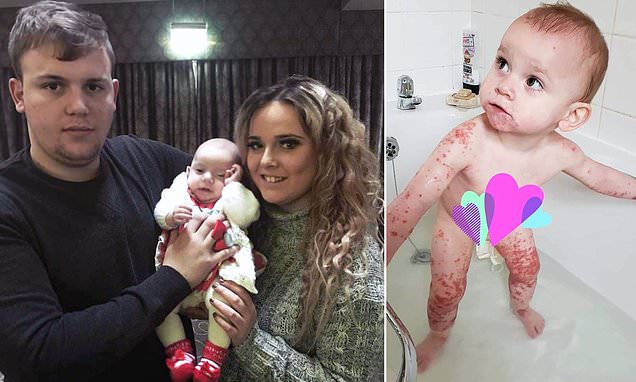 Foshnja lufton me jetën prej puthjes së familjarit!