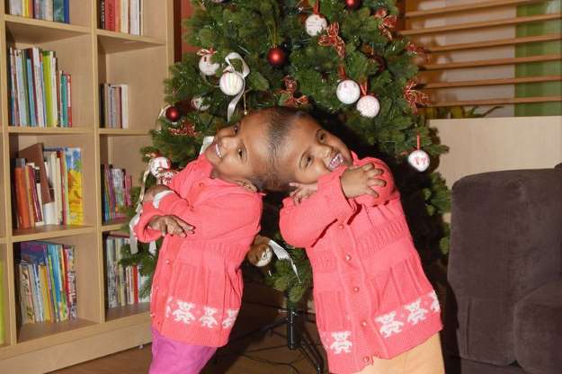 Binjaket e bashkuara do t’i nënshtrohen operacionit të ndarjes