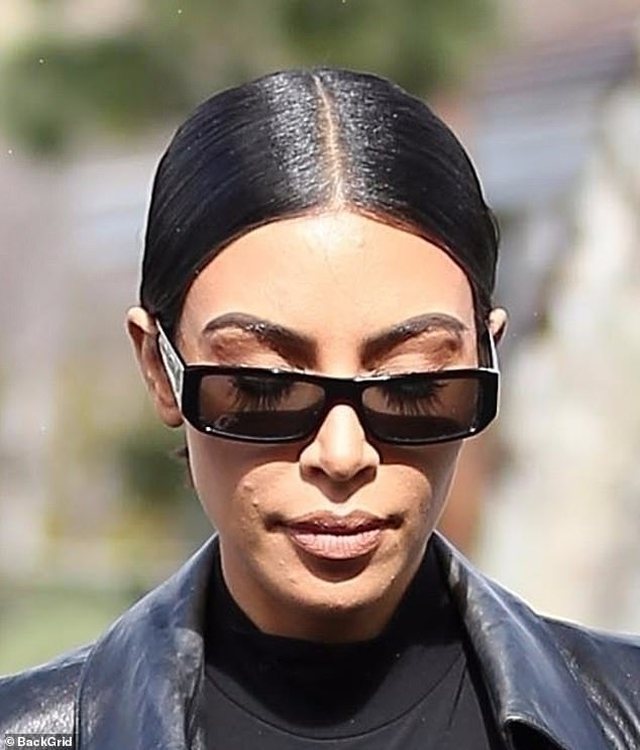 Paparacët fotografuan shenja në fytyrën e saj, reagon Kim Kardashian