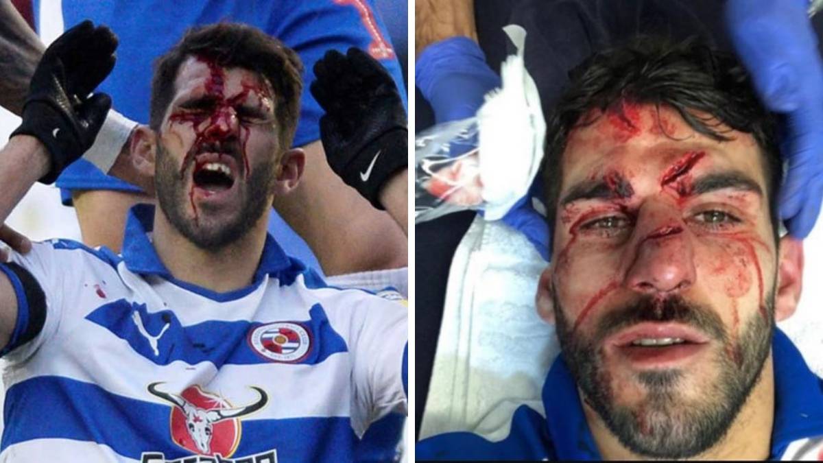 Kundërshtari e shkel me këmbë në fytyrë, ja rezultati horror