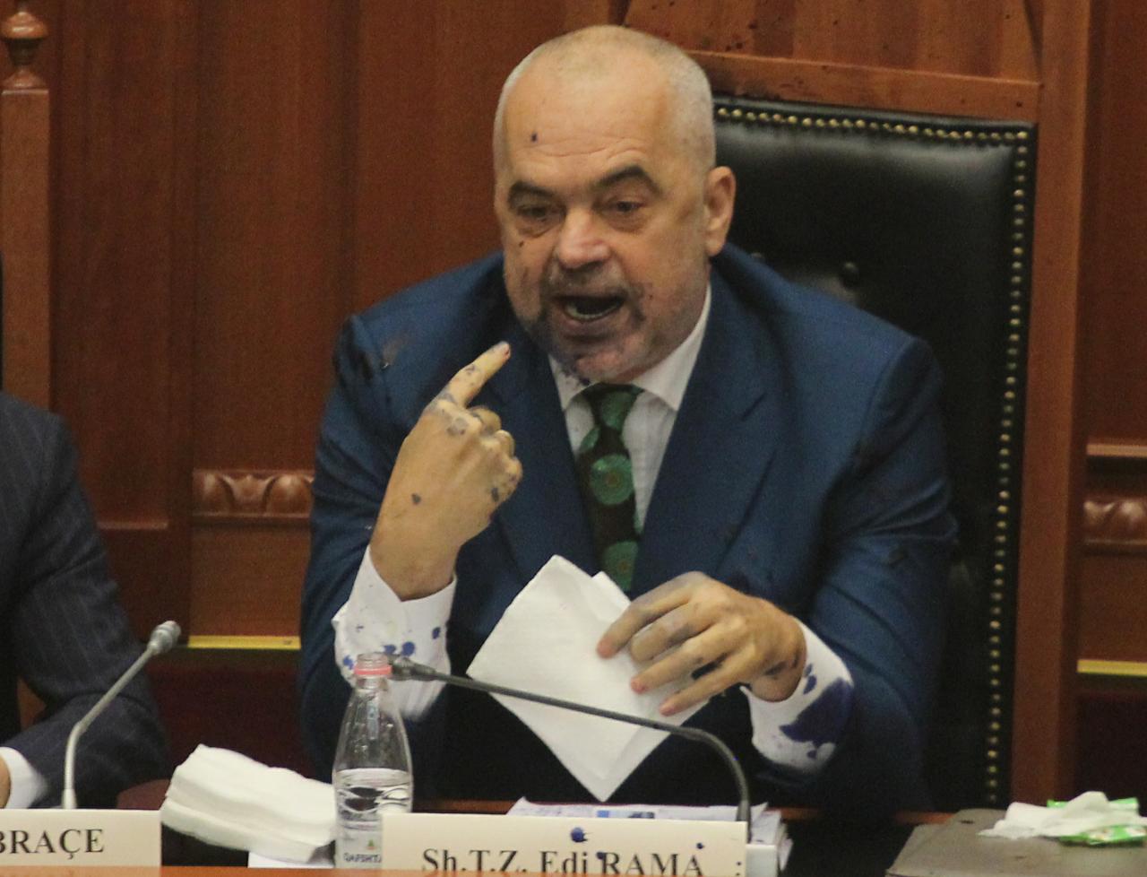 Ish-kryeministri Berisha ka një pyetje për shqiptarët (VIDEO)