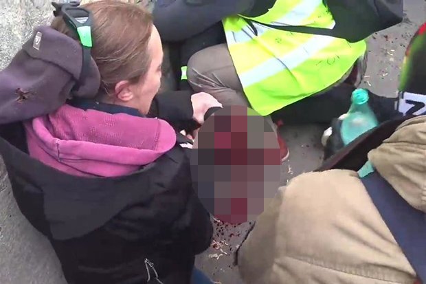 Granata ndaj “jelekverdhëve”, njërit i humb dora (FOTO)