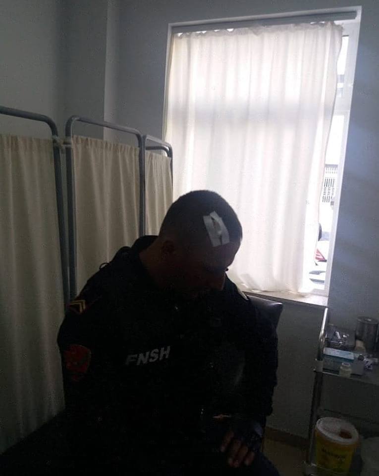 Goditi me gurë në kokë policin në protestë, arrestohet punonjësi i bashkisë