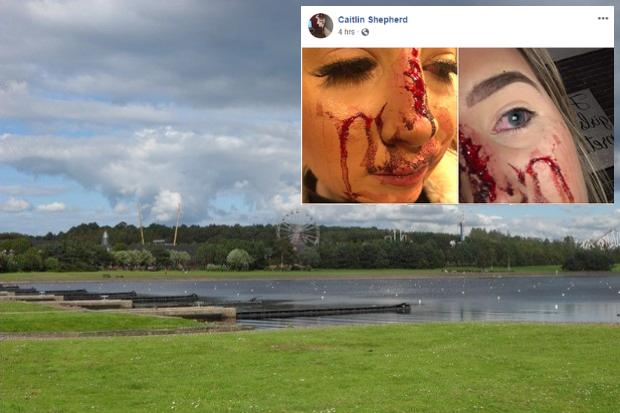 19-vjeçarja rrihet brutalisht nga dy të panjohura