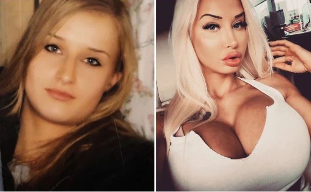 Ish-të dashurit i dhanë 50 mijë paund për kirurgji plastike