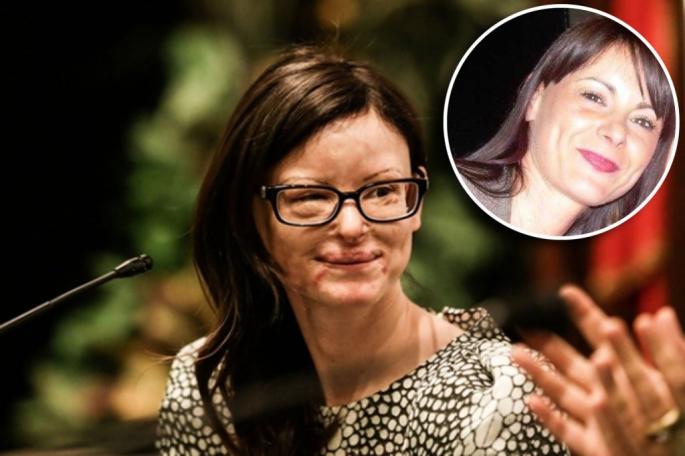 I hodhi acid në fytyrë, shqiptari i dërgon letër avokates: Më fal Lucia