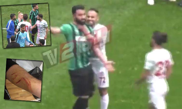 E turpshme, kasapi turk, skualifikohet vetëm me një ndeshje! (VIDEO)