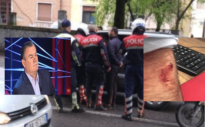 “Shqiponjat” tentuan ta shoqëronin, botuesi Nikoll Lesi i gjakosur (FOTO)