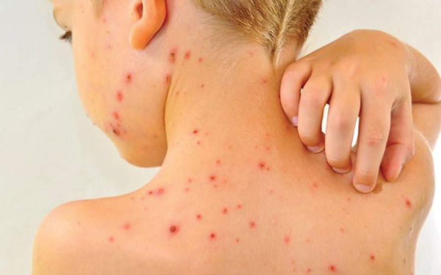 Shtohen rastet e prekjes nga fruthi