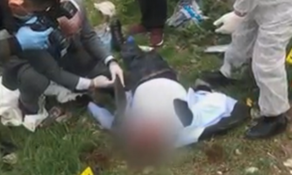 I vrari Admir Murataj kishte kryer operacione në fytyrë