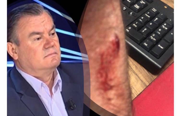 U dhunua nga policia, gazetari letër Lleshajt: Mos i lër të t’i nxijnë ato flokë të bardha