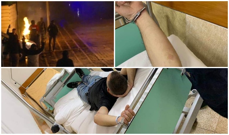 Ish-deputeti publikon fotot e protestuesit të dhunuar: E lidhën me pranga në spital