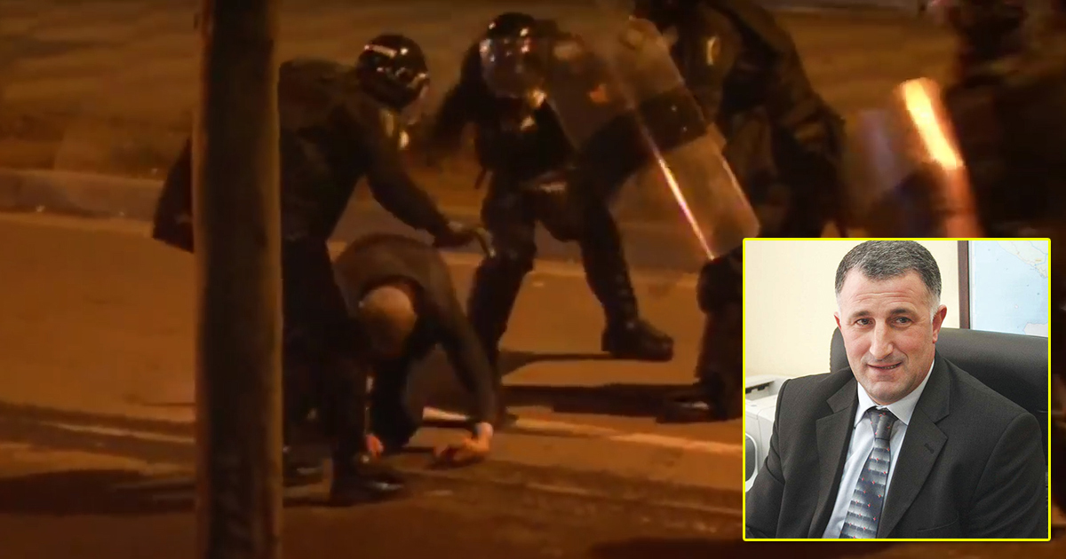 U dhunua nga policia, flet për herë të parë Sahit Dollapi: Arben Baro dha urdhër ‘kapeni dhe mbyteni’