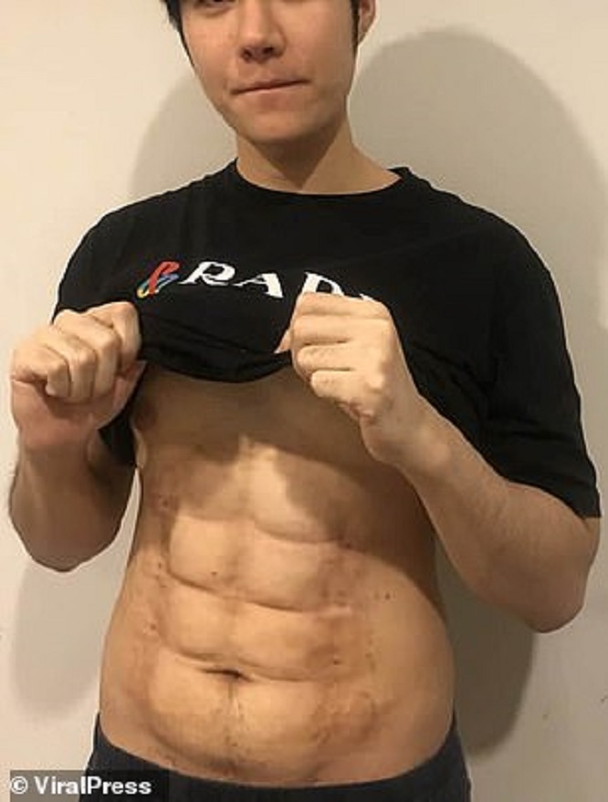 FOTO/ 24-vjeçari shpenzon mijëra paundë për muskuj fallso