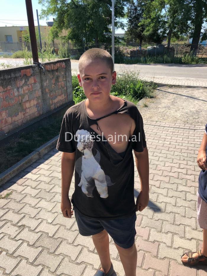 Durrës, PD denoncon dhunimin e një fëmije të mitur, dhunohet edhe kreu i njësisë administrative të Katundit të ri (FOTO)