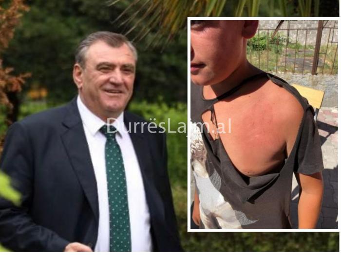 Agron Duka: Faji i të miturit që u dhunua në Durrës ishte thirrja “Rama ik”