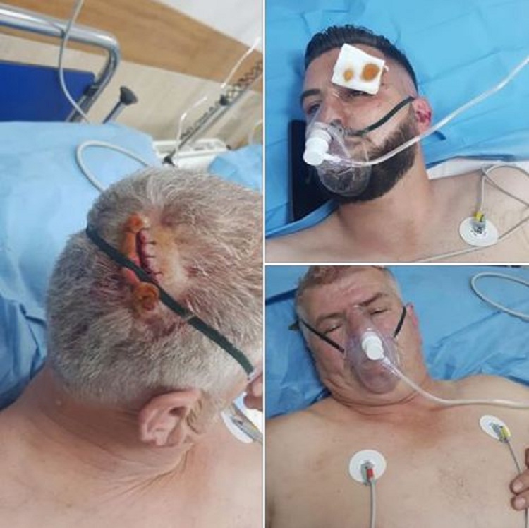 Të çara në kokë dhe nofull, fotot e protestuesve nga spitali