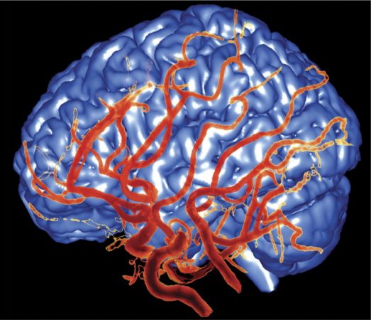 Enët e gjakut në qafë tregues i Alzheimerit