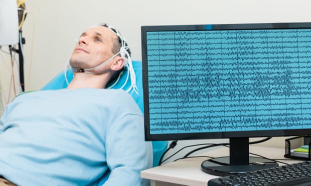 Shkencëtarët arrijnë të përkthejnë sinjalet e trurit në tekst të shkruar