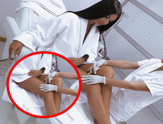 Zaimina Vasjari tregon terapinë për zhdukjen e celulitit