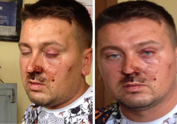 EMRI/ Ky është i riu ndaj shtëpisë së të cilit u qëllua me breshëri plumbash