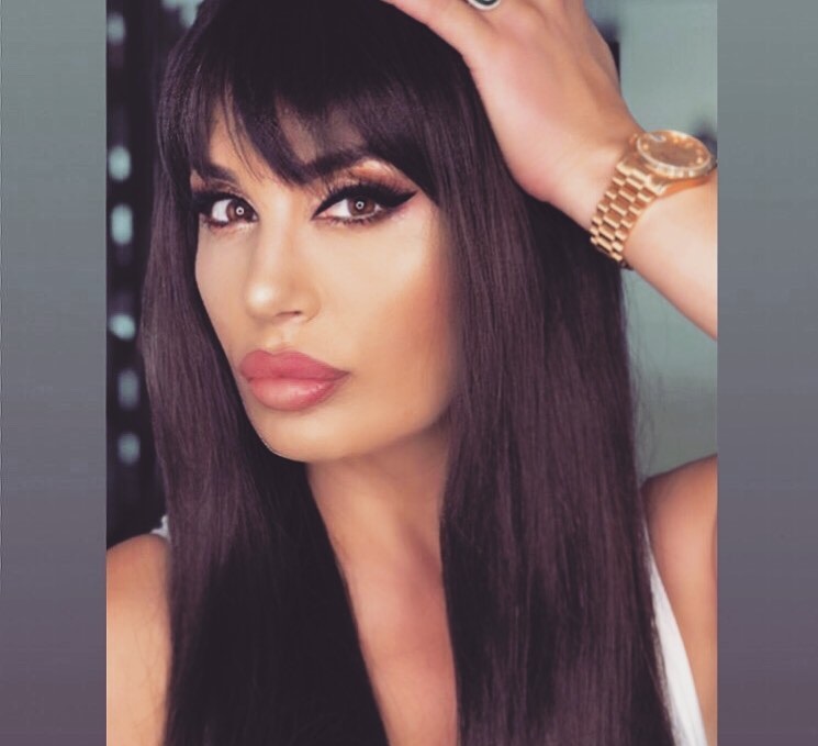 “Më shumë se gjysma janë këputur”, Albërie Hadërgjonaj e pëson keq nga flokët extesions (FOTO)