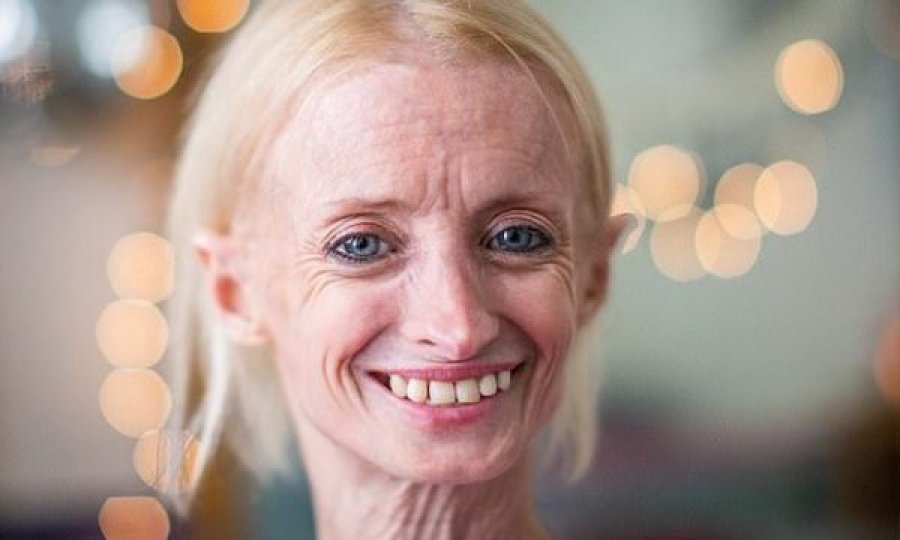 Kjo është gruaja që plaket tetë herë më shpejt se çdo person tjetër