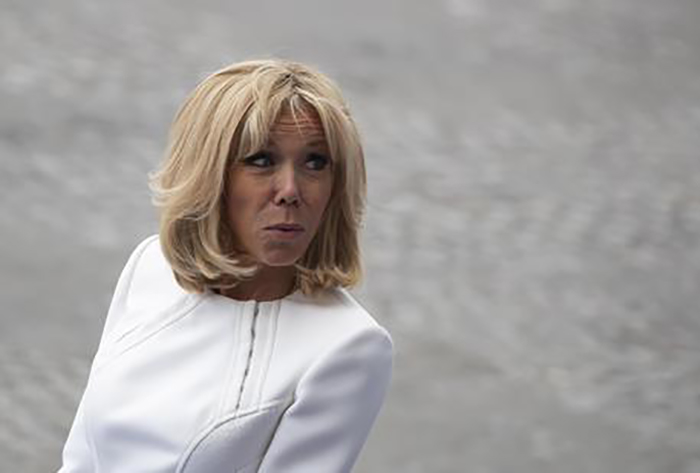 Bashkëshortja e presidentit Macron i nënshtrohet kirurgjisë estetike