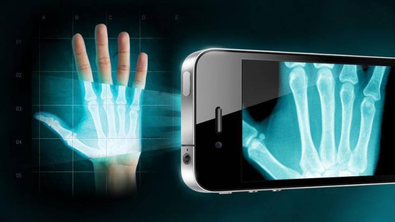 Shpiket fotokamera me rreze x, revolucion në studimin e materieve