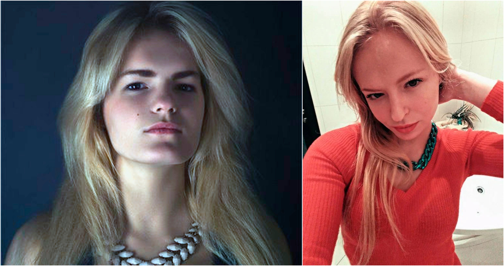 Vret motrën modele nga xhelozia, i nxjerr sytë