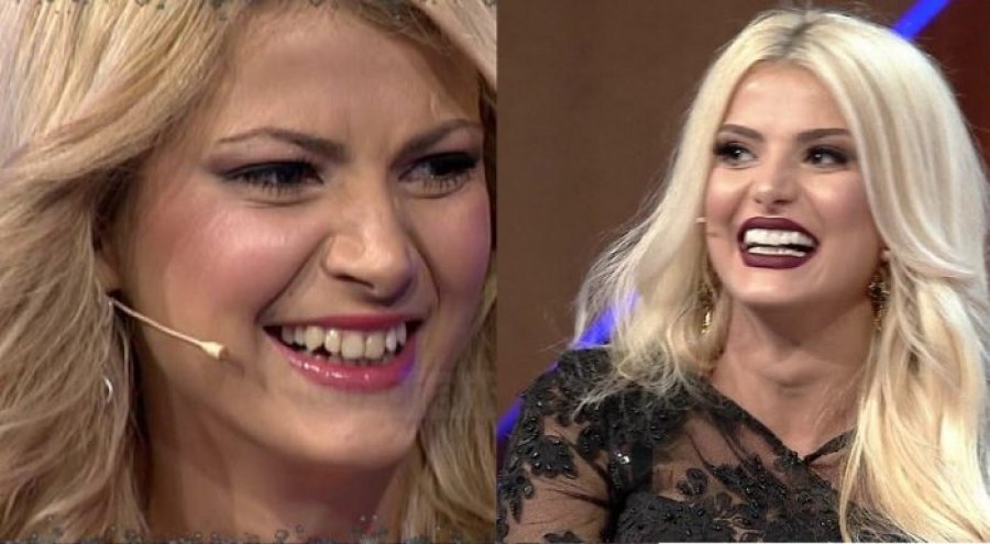 Ka bërë apo jo operacione plastike? Fotot e Marina Vjollcës shtojnë dyshimet