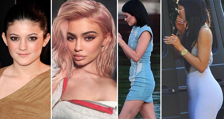“Nga buzët deri tek të pasmet”, sa ka shpenzuar Kylie Jenner për të transformuar pamjen