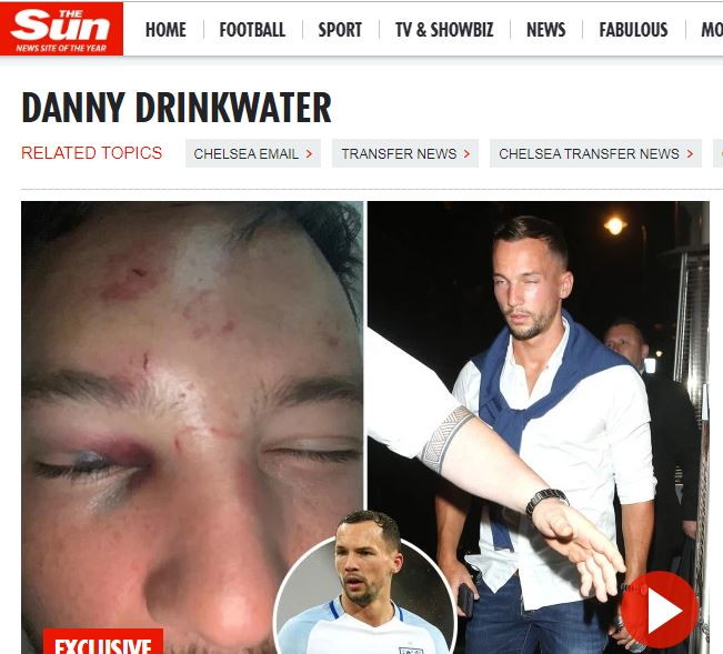 Ngacmoi femrën që nuk duhej, ish-lojtari i Çelsit dhunohet keq në një lokal nate