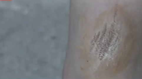 U hodh nga ballkoni me djalin e mitur, gruaja: Tërmeti na shkatërroi shtëpinë