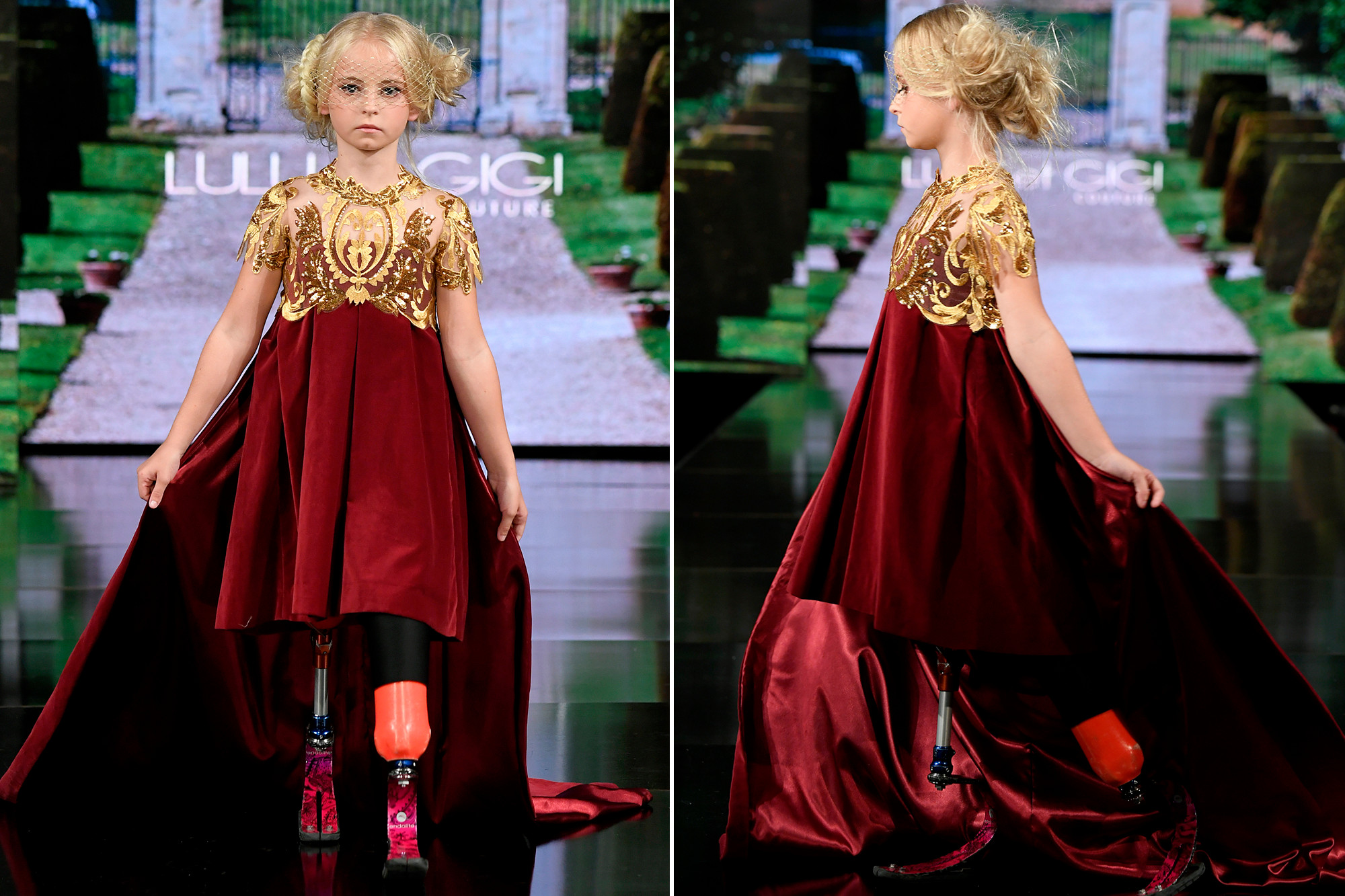 Vajza me këmbët e prera shkëlqen në pasarelën në Paris