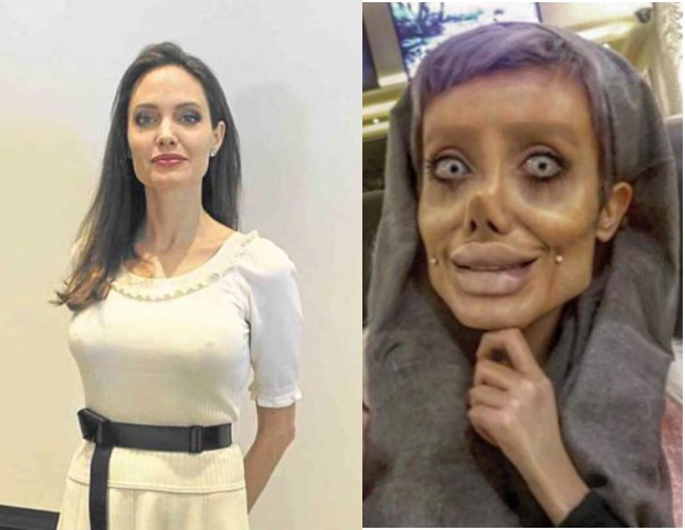 Arrestohet “ylli” iranian i Instagramit, u operua që të dukej si Angelina Jolie