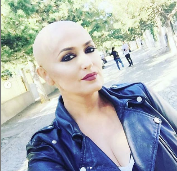 Këngëtarja e njohur shqiptare qeth flokët zero për një arsye prekëse