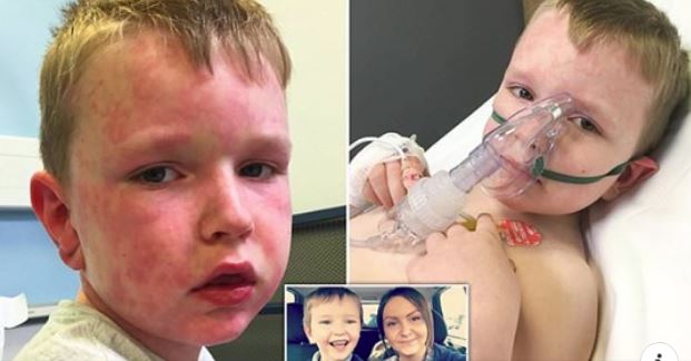 7-vjeçari që është alergjik ndaj dimrit