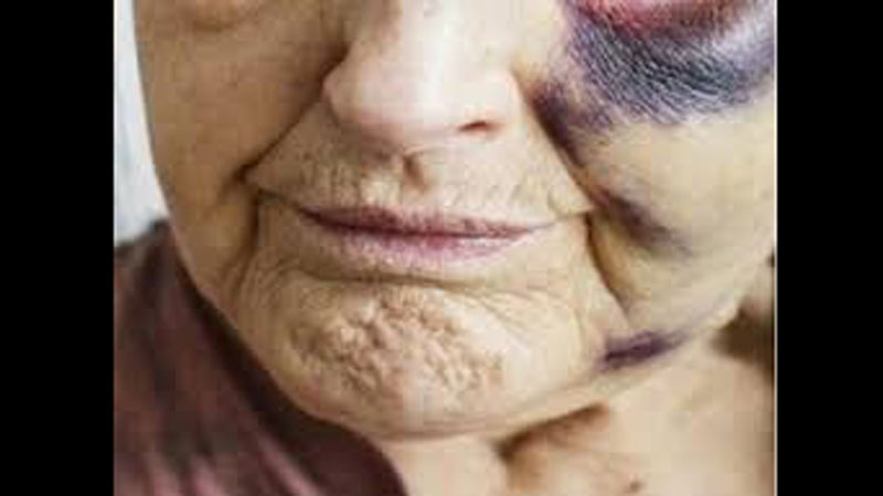 Arrestohet 54-vjeçari, ushtronte dhunë fizike ndaj nënës së tij