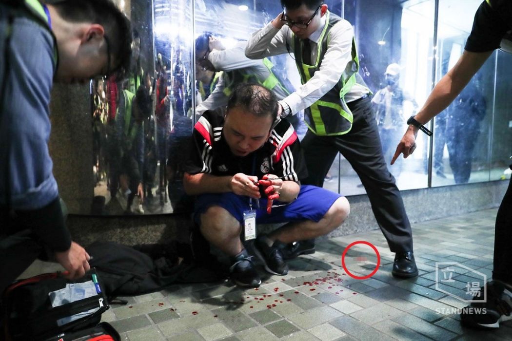 Skena “horror” në Hong Kong, protestuesi i shqyen veshin politikanit