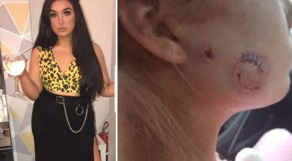 8 qepje në faqe sepse doli me ish-in e shoqes së saj! (FOTO)