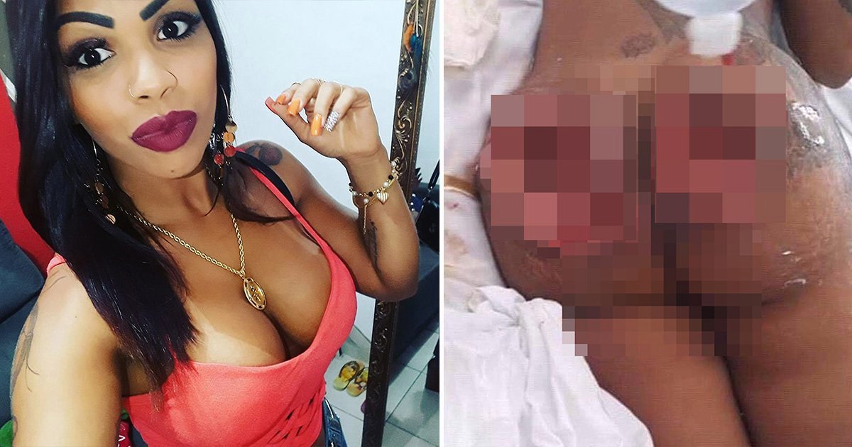 Zmadhimi i të pasmeve shkon shumë keq, mbetet me vrima nga infeksioni