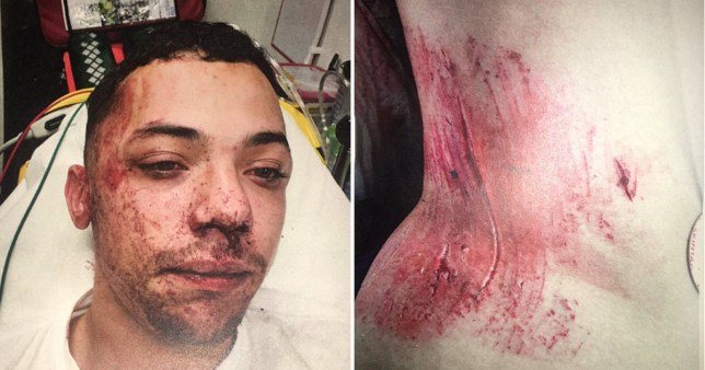 Talli futbollistin për vëllain e vdekur, pëson aksident