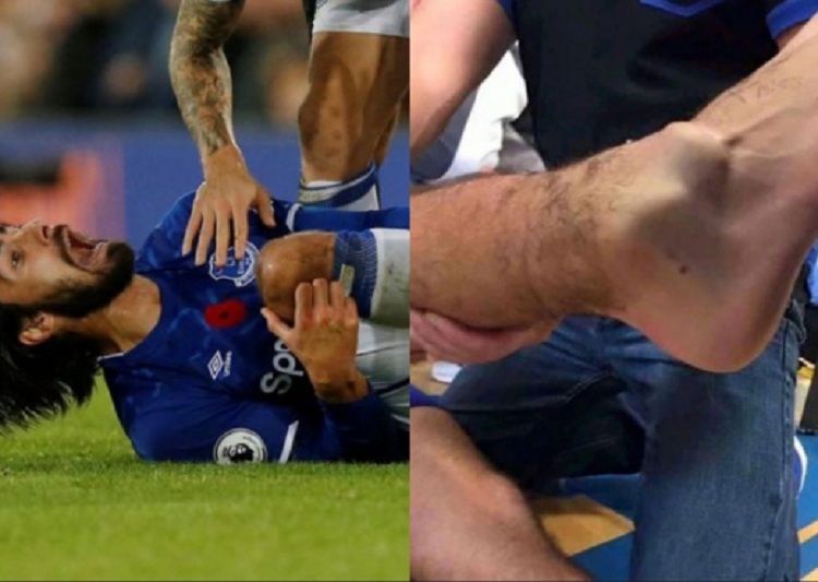 Dëmtim horror në Premier Ligë, Son i thyen këmbën ish-lojtarit të Barcelonës (VIDEO)