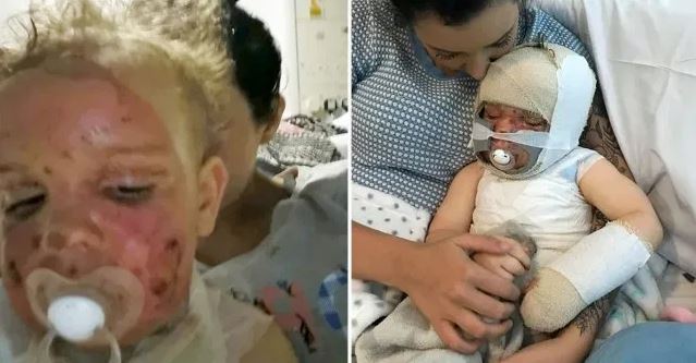 Vogëlushi derdh mbi trup tenxheren me ujë të valuar