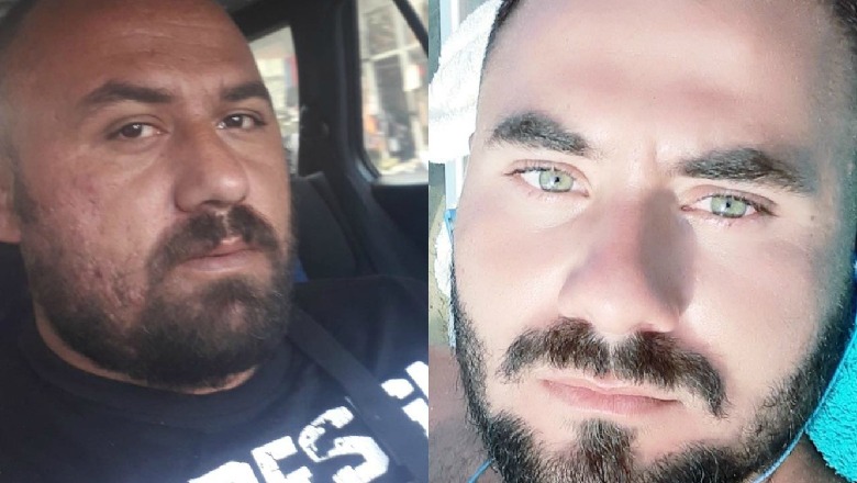 Hotel “Tropikal” në Durrës u ndërtua pa projekt konstruksioni, pas legalizimit u bë edhe kati shtesë