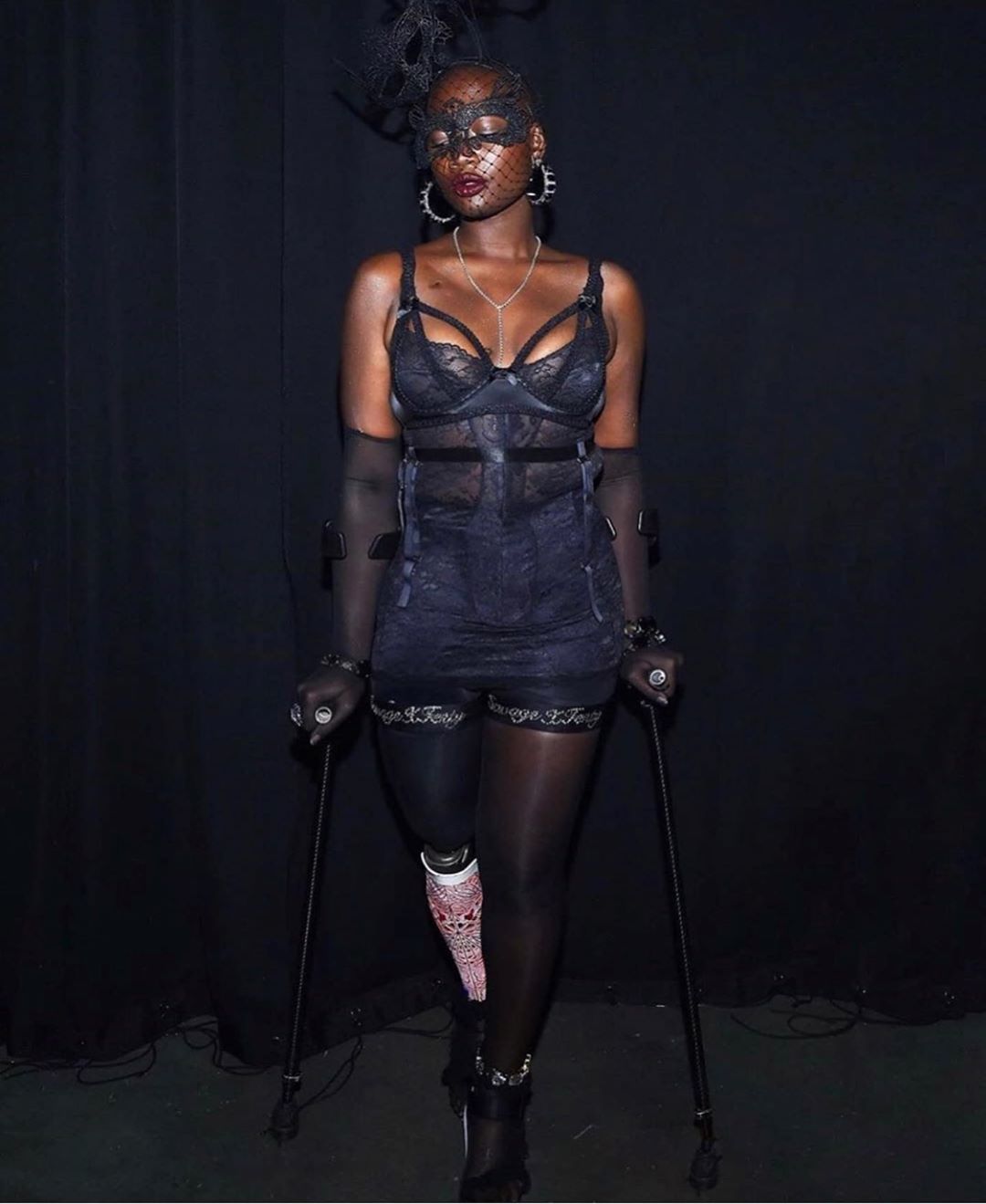 Fitoi betejën me kancerin, ndahet nga jeta modelja me këmbën protezë