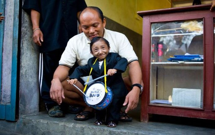 Ndahet nga jeta burri më i shkurtër në botë
