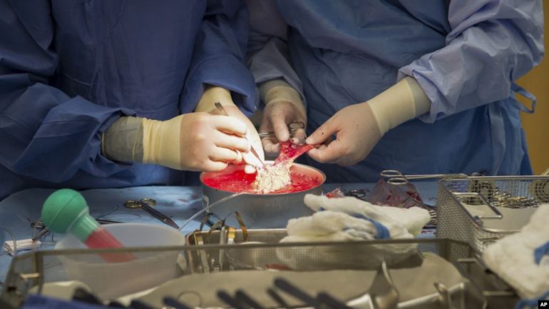 Teknologji e re për transplantimin e mëlçisë