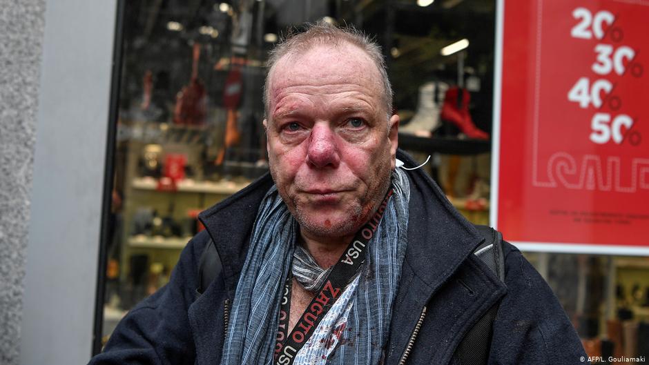 Greqi: Dhunë e re e ekstremistëve të djathtë